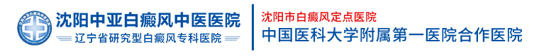 沈阳白癜风专科医院-沈阳中亚白癜风医院「正规」辽宁沈阳白癜风医院-专业治疗白癜风|白斑病
